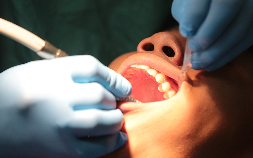 Odonto2